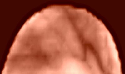 diffuse-optical-400x236