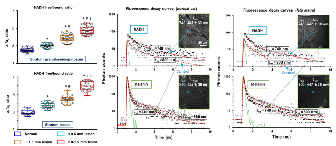 超快熒光壽命成像應用于皮膚癌早期檢測 超快熒光壽命成像應用于皮膚癌早期檢測