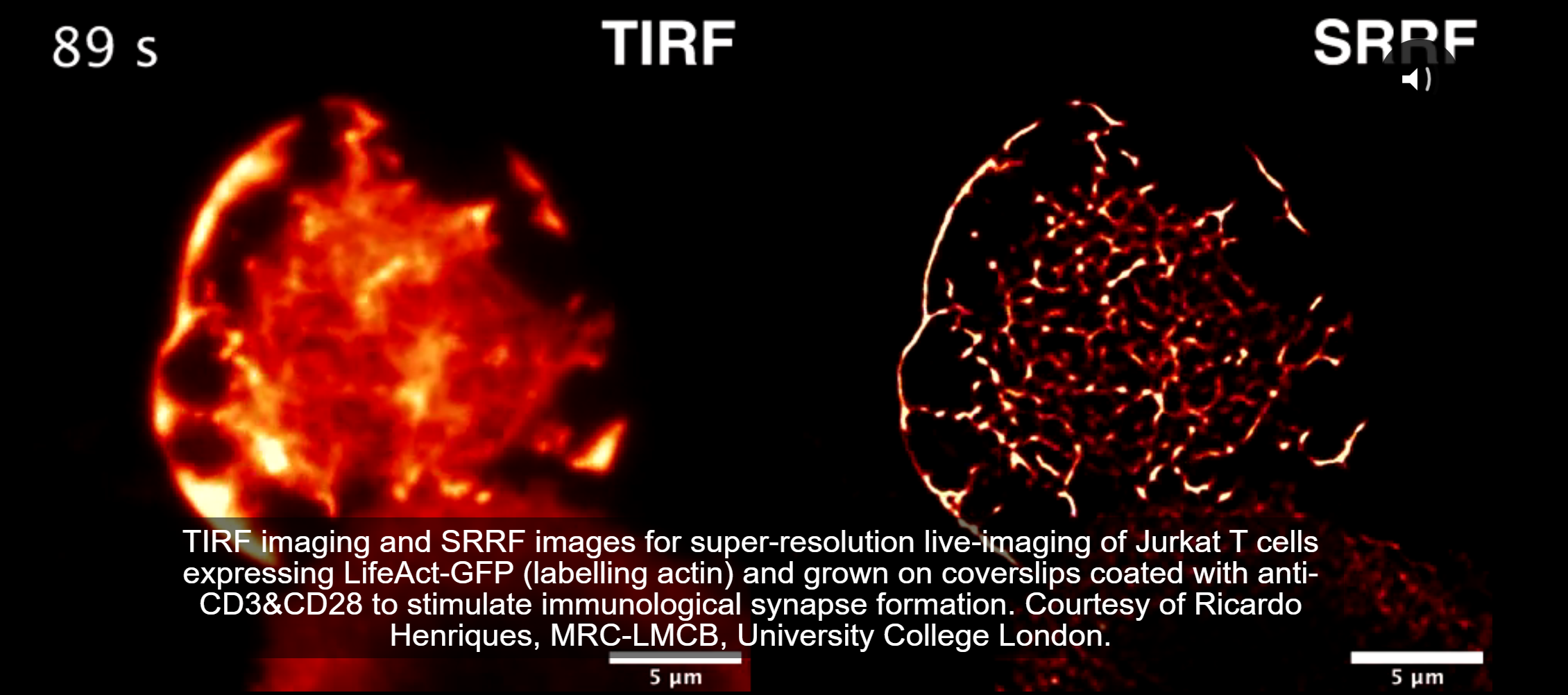 andor SRRF Tirf imaging